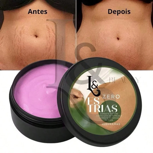 Creme Zero Estrias Removedor Anti Estrias Trata E Previne 150g - L&Beauty
