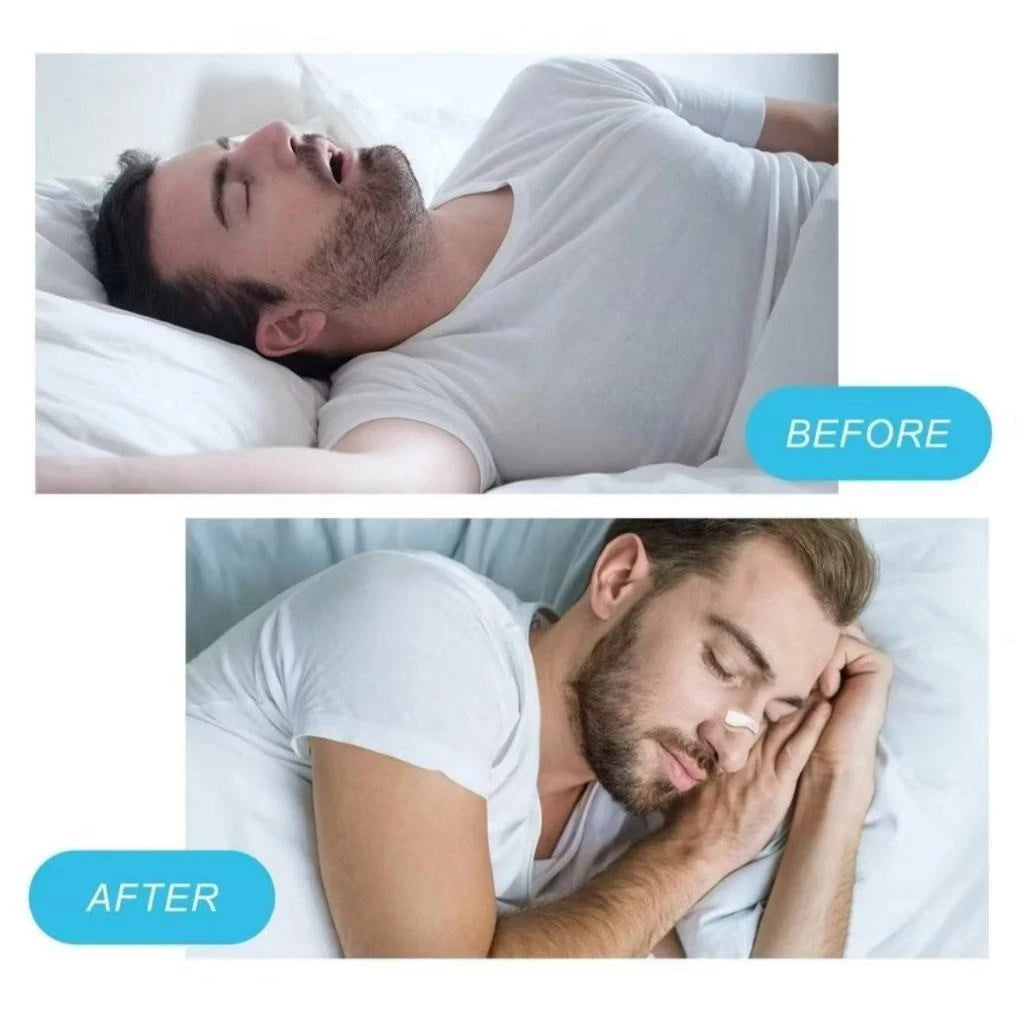 Dilatador Nasal Sono Dilatadores De Respiração Starter Kit Nariz Respirar Tiras Nasais Magnéticas Reduzir Ronco 🌙✨